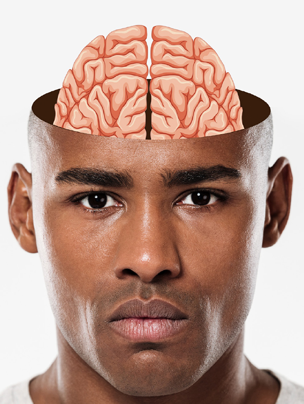 Atake di advertensia selebral